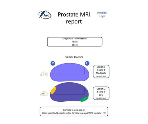 Prostate MRI report template