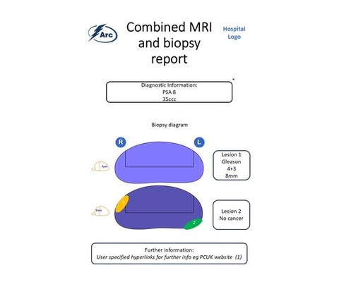 Combined MRI and biopsy report preview